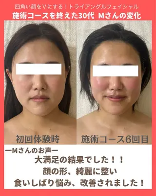 la lumie're (ラ リュミエール)所属・小顔サロン (ラ リュミエール)のエステ・リラクイメージ