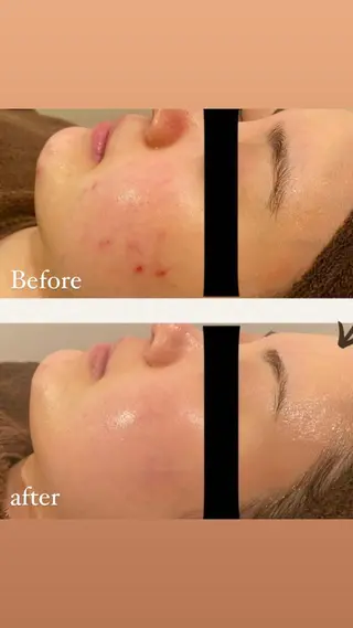 本気の肌質改善スキン デトックス🌿のエステ・リラクイメージ