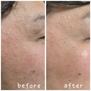 結果が出るスキンケア 肌質改善/まつパのエステ・リラクイメージ