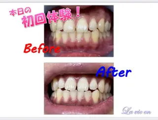 セルフホワイトニングサロン　ラヴィアン所属・ホワイトニングサロン La vie enのその他イメージ