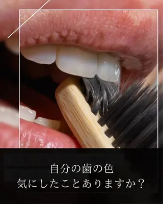 ホワイトニングショップ津店所属・ホワイトニング ショップ津店のその他イメージ