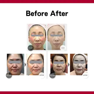 SHAPY HIGH SLIMMING ESTHETIC所属・嚴 キララのエステ・リラクイメージ