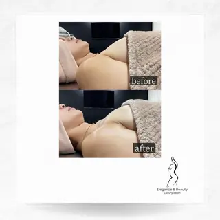 Elegance&Beauty バストアップ専門店所属・Elegance &Beauty 船橋のエステ・リラクイメージ