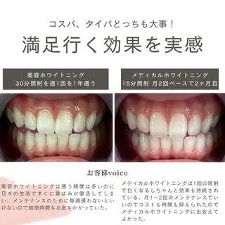Whitening Carat 恵比寿店所属・ホワイトニング カラット 恵比寿店のエステ・リラクイメージ