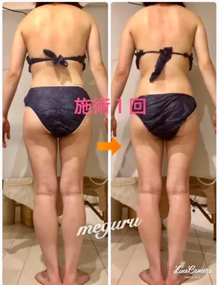 ロング カラー パーマ ヘアアレンジ メンズ キッズ ネイル マツエク・マツパ ‍痩身＆ボディ 結果出し🌟丹野のエステ・リラクイメージ