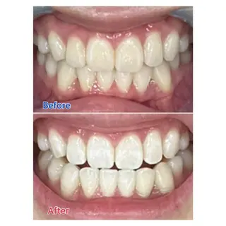 MBEAUTYSALON 千葉店・京成大久保所属・Melty 輝のその他イメージ