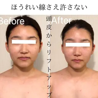 リフトアップ小顔 専門のエステ・リラクイメージ