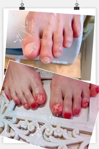 ネイル リン リンのネイルデザイン