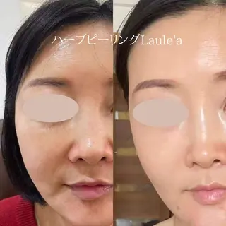 美腸サロン🌺 腸もみ/小顔/リンパのエステ・リラクイメージ