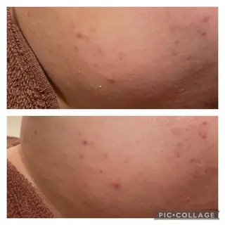 ミディアム カラー パーマ ヘアアレンジ メンズ キッズ ネイル マツエク・マツパ アイブロウ ニキビ特化型エステ 🍓最短で肌質改善のエステ・リラクイメージ