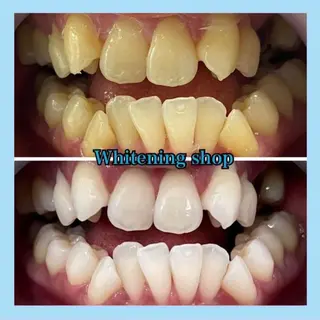 ホワイトニング ショップ千葉店のその他イメージ