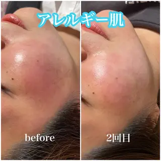 毛穴レス ハーブ＆ ワックス脱毛×光脱毛のエステ・リラクイメージ