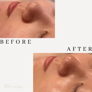 サンス エイジのエステ・リラクイメージ