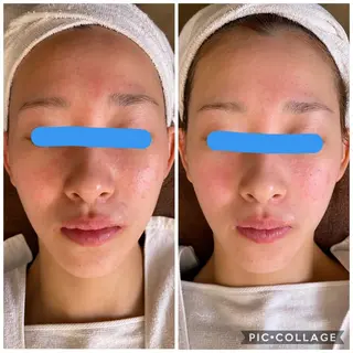 ナリスビューティーサロンつくば店所属・バストアップサロン -Sirius-かずのエステ・リラクイメージ