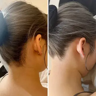 うなじ脱毛/美肌脱毛 LABELのエステ・リラクイメージ