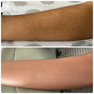 yellow.所属・yellow💛【 脱毛&フェイシャル】のエステ・リラクイメージ