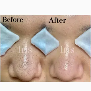 Aki 似合わせまつ毛💎のエステ・リラクイメージ