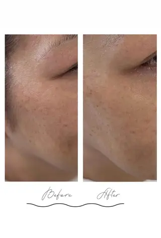 デ・アイム京橋所属・長谷川 華音のエステ・リラクイメージ