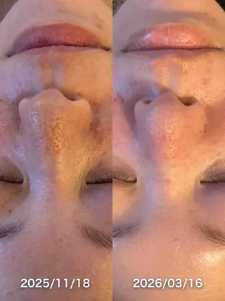 美容彫刻家 hiroのエステ・リラクイメージ