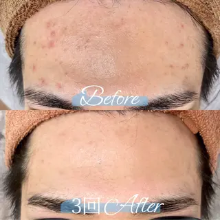 都度払い脱毛 BARNEYのエステ・リラクイメージ