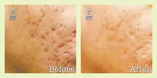 美肌脱毛フェイシャル サロンAMOのエステ・リラクイメージ