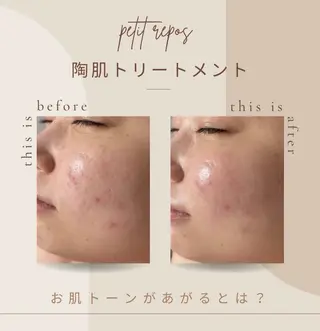 petit repos所属・吉田 和のエステ・リラクイメージ