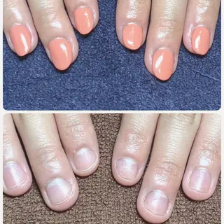 ネイル 深爪矯正/爪育成ケア manie nailのネイルデザイン