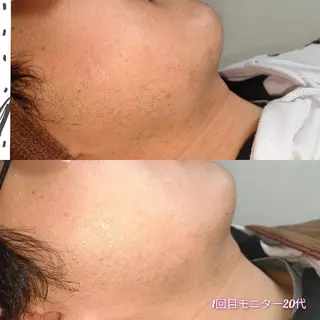 メンズ 武 藤のエステ・リラクイメージ