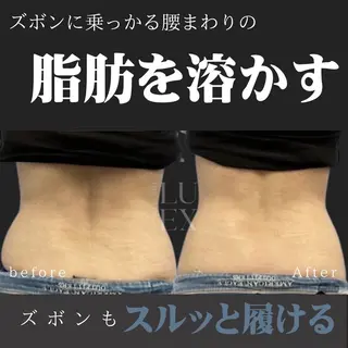 痩身専門サロン Saoriのエステ・リラクイメージ