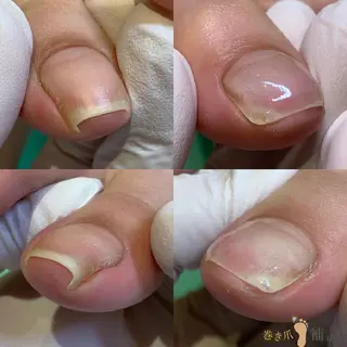 ネイル 東京巻き爪アカデミー所属・東京巻き爪 アカデミーのエステ・リラクイメージ