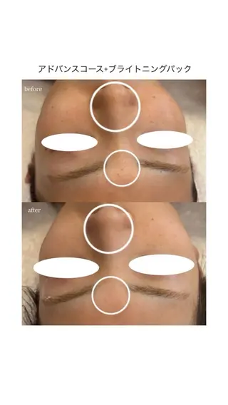 メナードフェイシャルサロン 熊本インター西店所属・フェイシャルエステ 🎀 naoのエステ・リラクイメージ