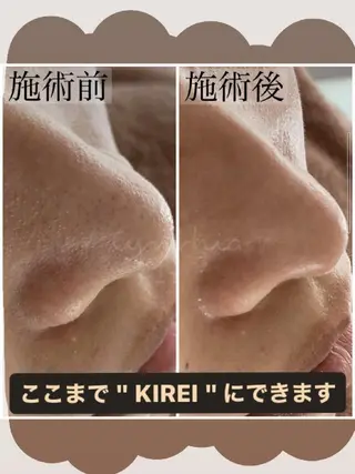 毛穴ケア専門店 Cynthiaのエステ・リラクイメージ