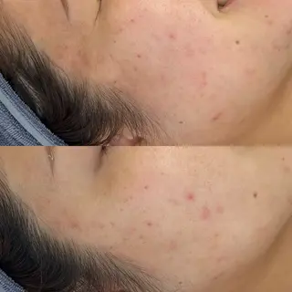 韓国🇰🇷価格 サロン_Nbibiのエステ・リラクイメージ