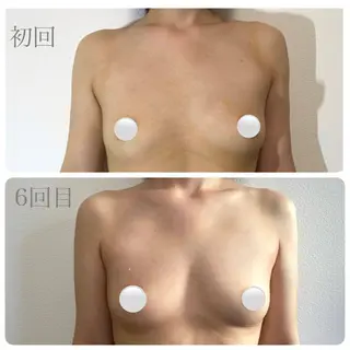 肌質改善＆ バストアップmimyのエステ・リラクイメージ