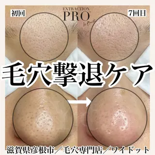 Ydot. 池内 友架のエステ・リラクイメージ