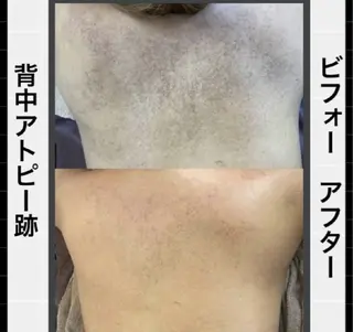 ハーブピーリング専門 COCO.梅田中津のエステ・リラクイメージ