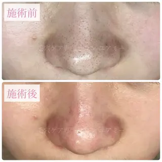 毛穴肌質ケアサロン Yourmeユアミーのエステ・リラクイメージ