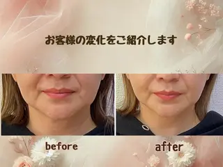 小顔矯正&美肌サロン ブプラ大元駅前店のエステ・リラクイメージ