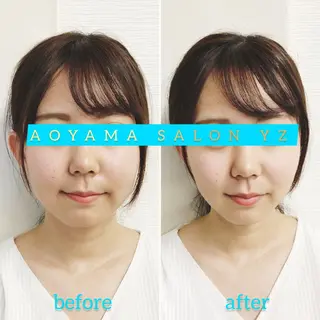 小顔美容鍼専門サロン 渋谷YZのエステ・リラクイメージ