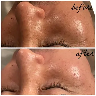 メンズ メナード岐阜市茜部 杉浦のエステ・リラクイメージ