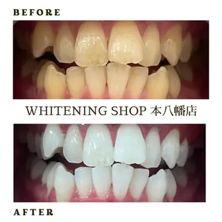 メンズ ホワイトニング ショップ本八幡店のエステ・リラクイメージ