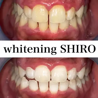 福岡ホワイトニング SHIRO天神店のエステ・リラクイメージ