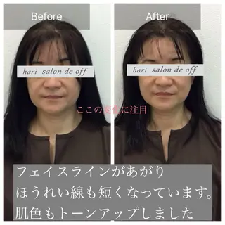 整体×美容鍼灸 鍼灸師Miyanoのエステ・リラクイメージ