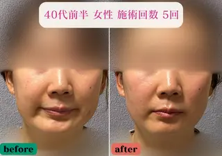 美容とカラダの鍼灸 サロン やなけんのエステ・リラクイメージ