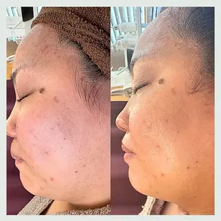 Florence  〜salon de nurse所属・Florence めぐみのエステ・リラクイメージ