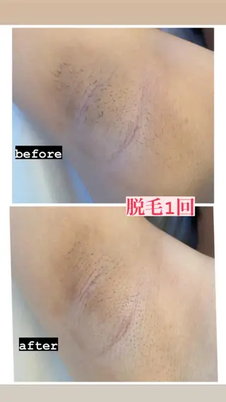 脱毛・エステサロン LuLuNのエステ・リラクイメージ