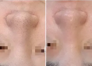 Hisui 種村のその他イメージ