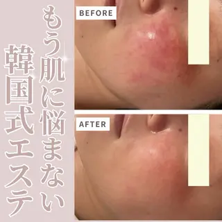 LittleBlue所属・新 紗季のエステ・リラクイメージ