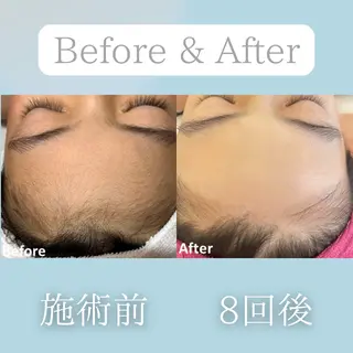 美肌脱毛&毛穴専門 Nico🐰ྀི♡のエステ・リラクイメージ