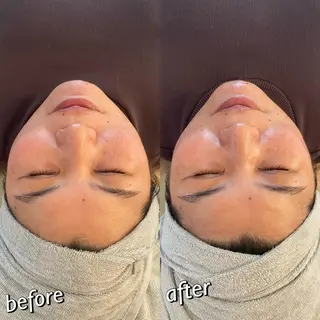 うなじ脱毛/美肌脱毛 LABELのエステ・リラクイメージ